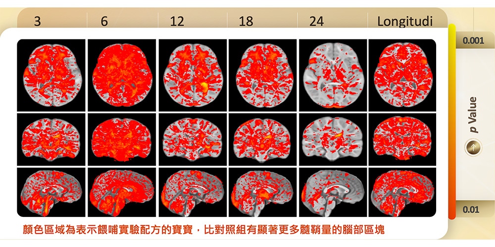 圖二：餵哺實驗配方的寶寶，比對照組有顯著更多髓鞘量的腦部區塊。該區塊的髓鞘量若顯著領先對照組，則以顏色顯示。